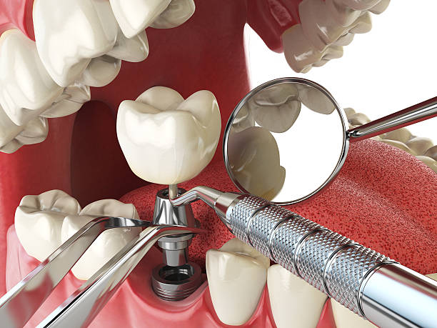 Best Orthodontic Emergency Dentist in Rexland Acres, CA